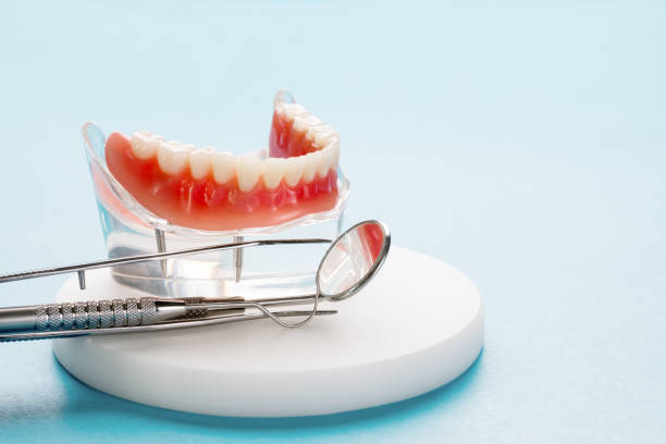 Dental Bonding in Albion, IN